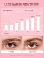 SHEGLAM - Sérum Croissance & Nutrition Gro - Pro - Véluxe - Daily Look